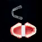 The Meaning Behind Teeth Falling Out in Your Dreams: Decoding the Symbolism